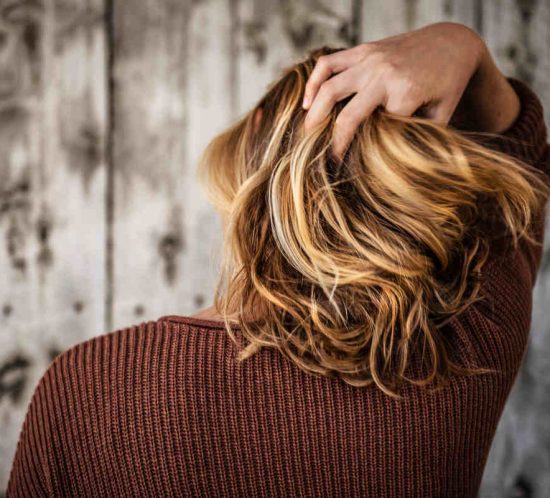 dry scalp
